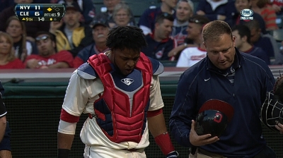Tribe relieved; Santana's thumb merely bruised