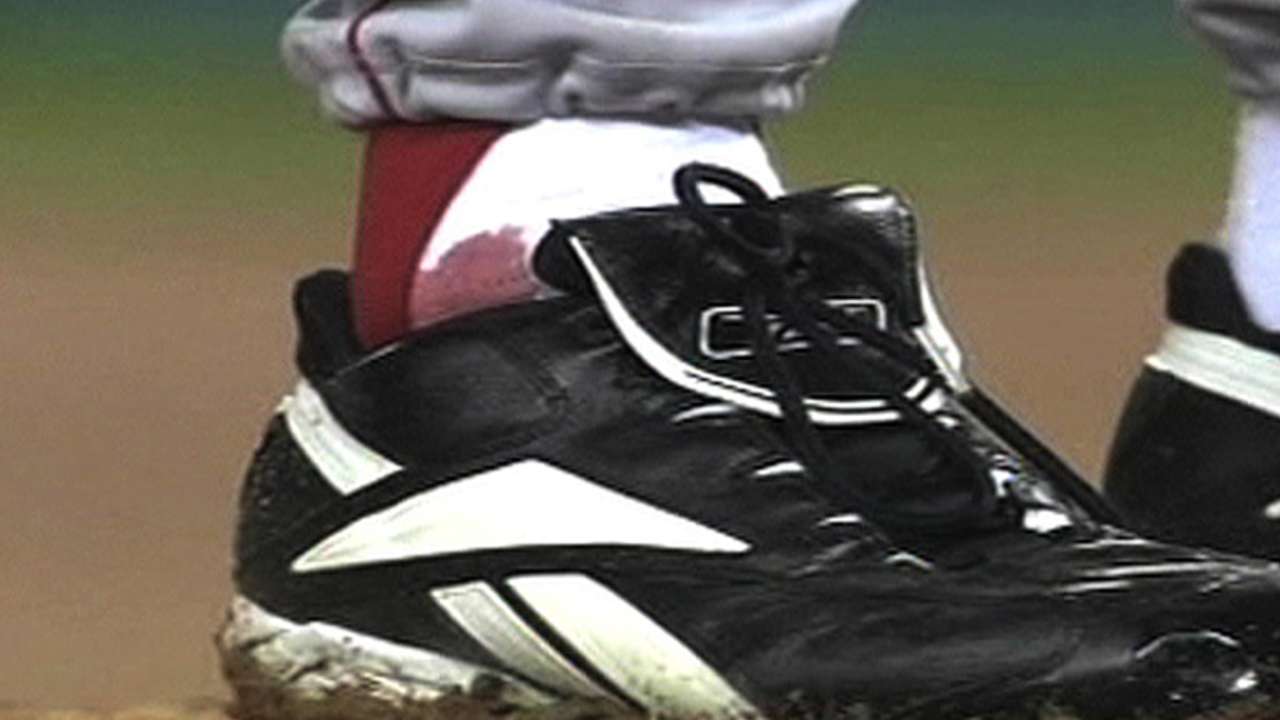 'Bloody Sock' should be on display in Hall of Fame
