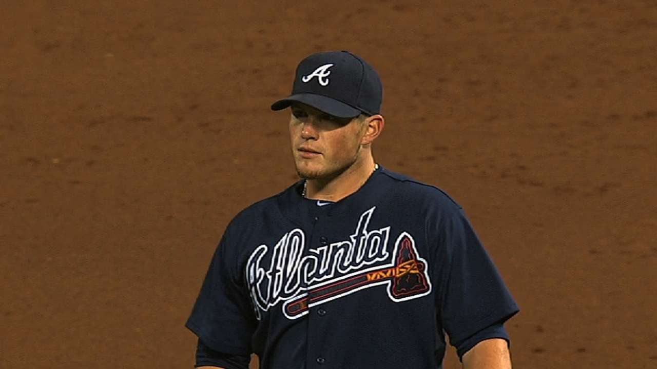 Braves' workload examined with elbow issues