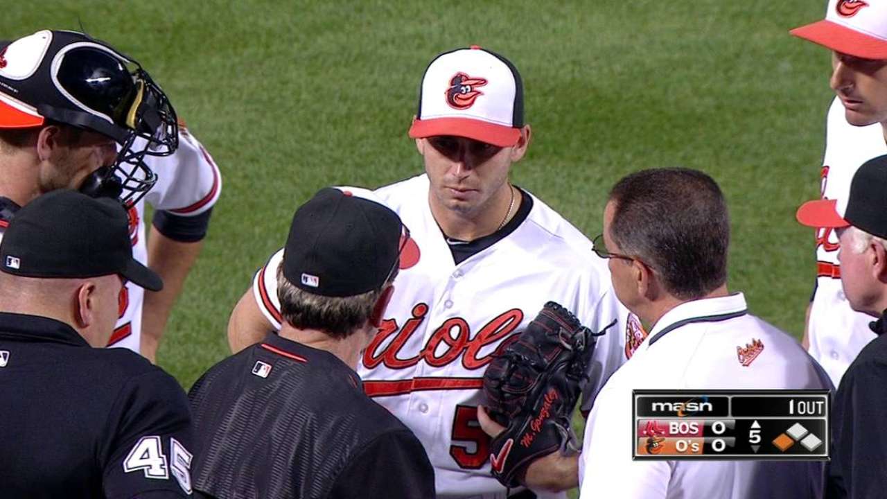 O's Gonzalez unlikely to start Sunday