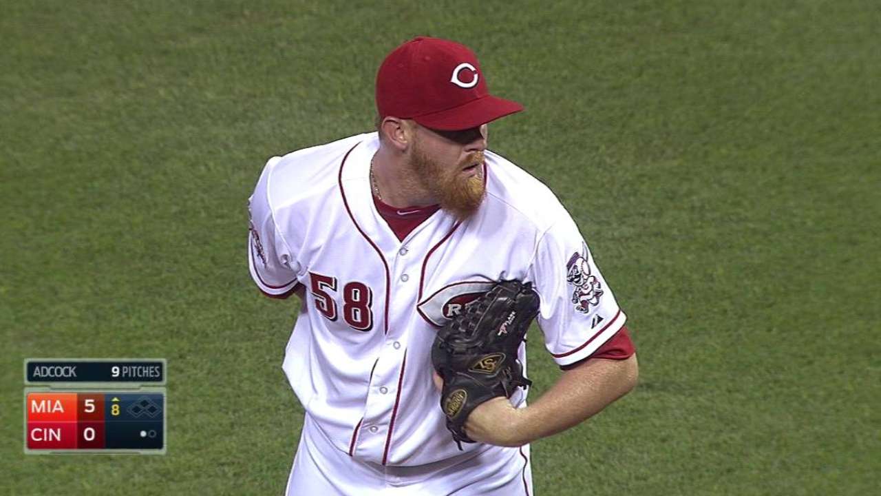 Adcock to DL, could have season-ending TJ