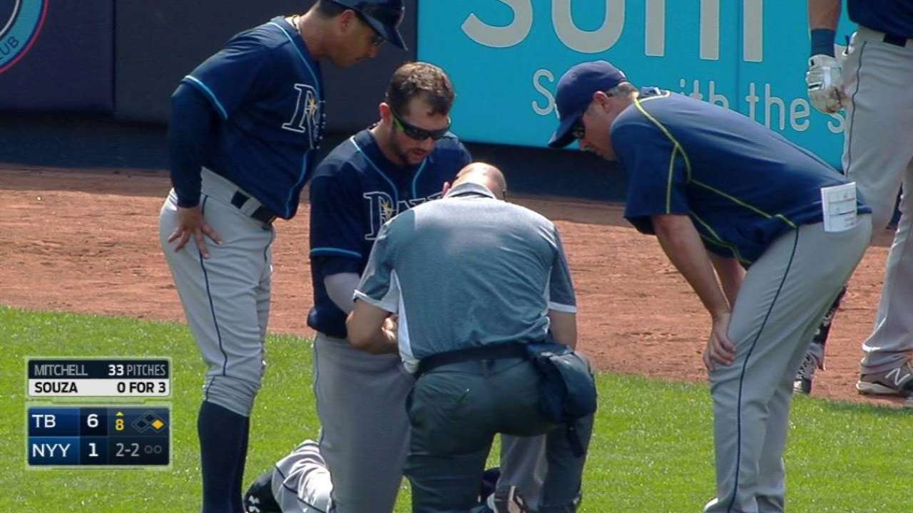 Souza requires stitches after pitch hits hand