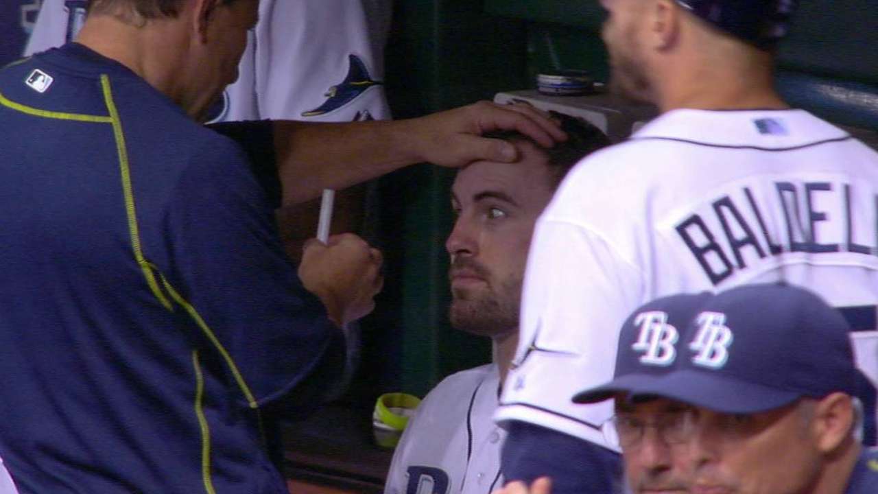 Casali says he's fine despite head contusion