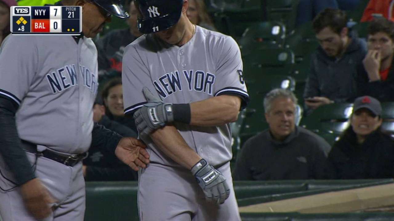 X-rays negative on Gardner's elbow after HBP