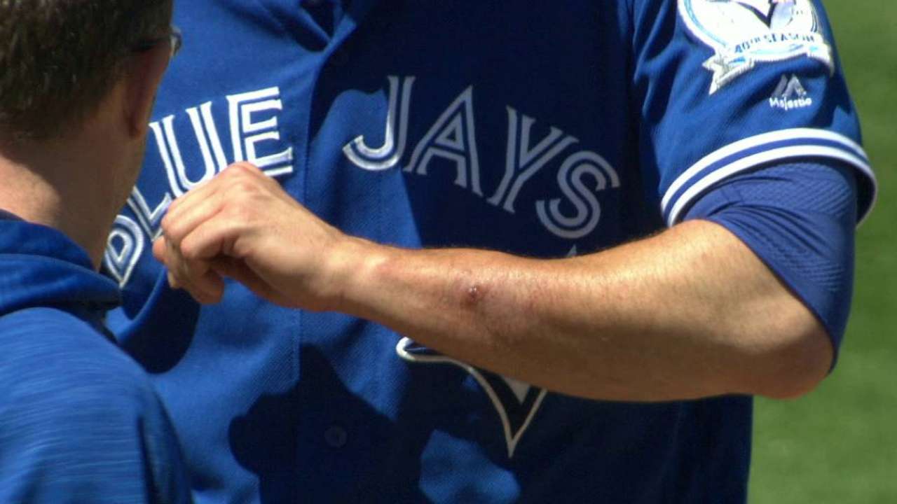 Happ shakes off comebacker scares
