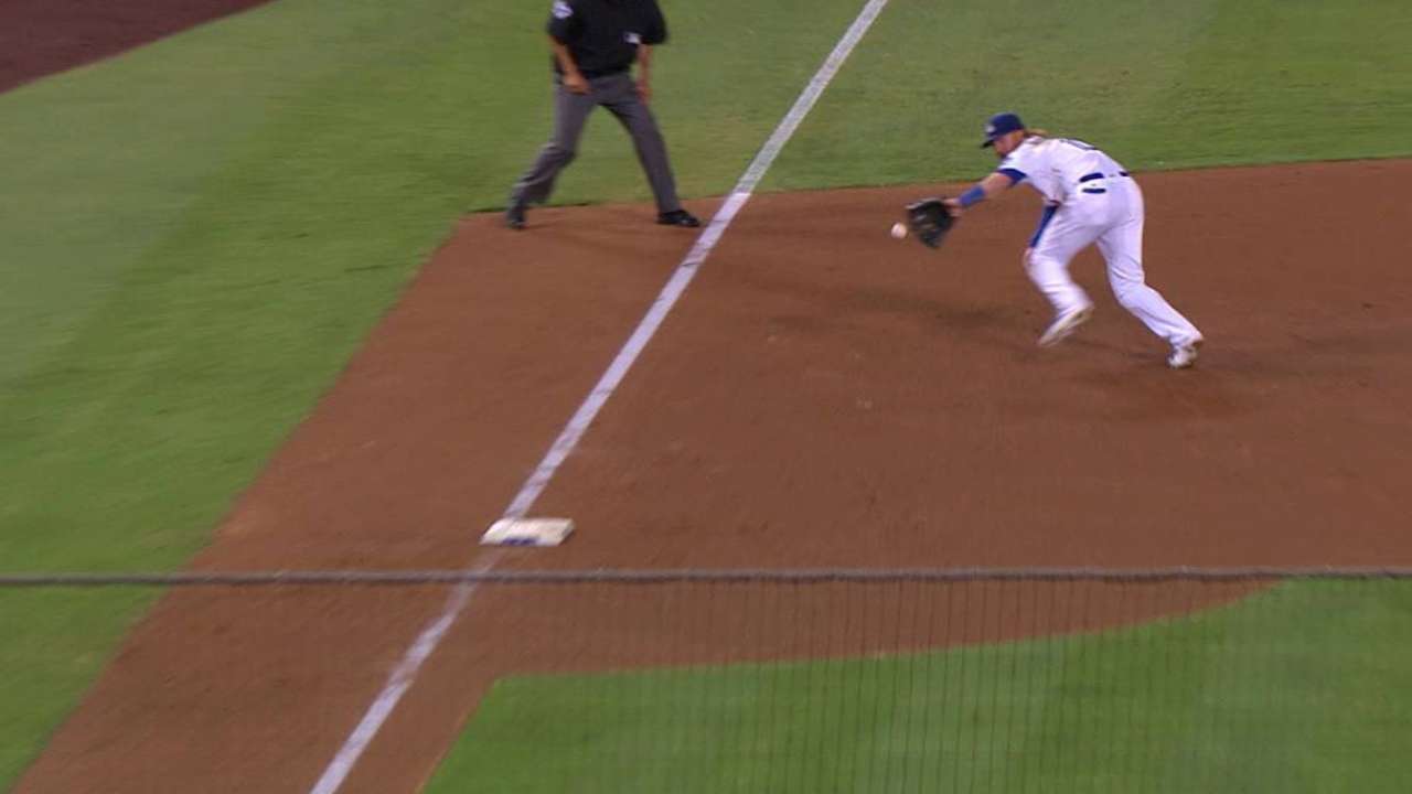 LA's Turner scratched with bruised right hand