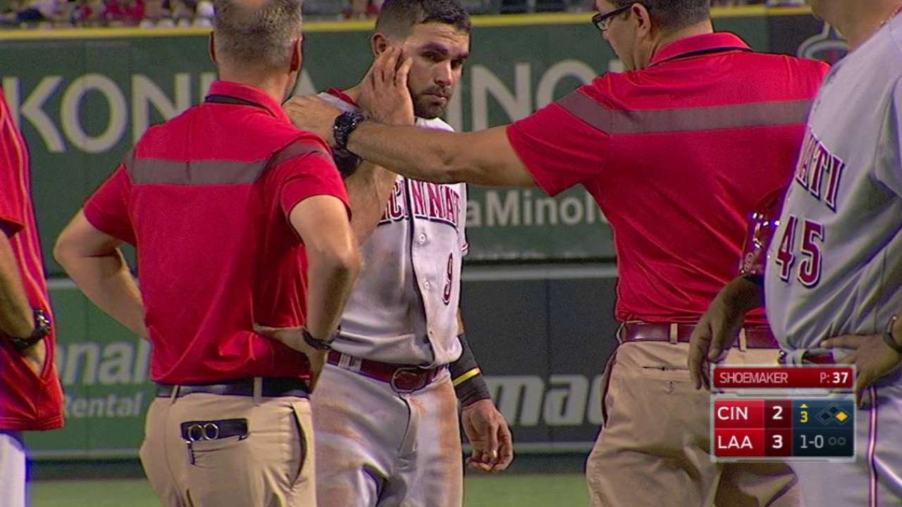 Peraza exits in the 3rd inning