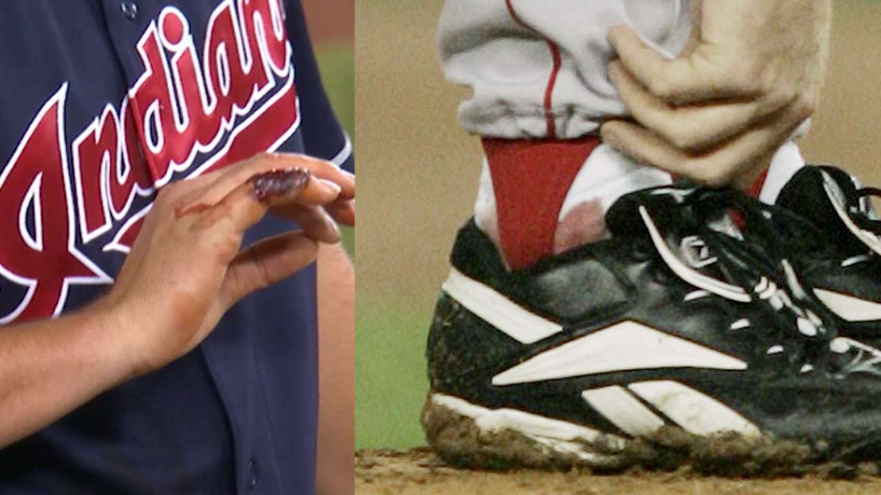 Francona on Schilling, Bauer