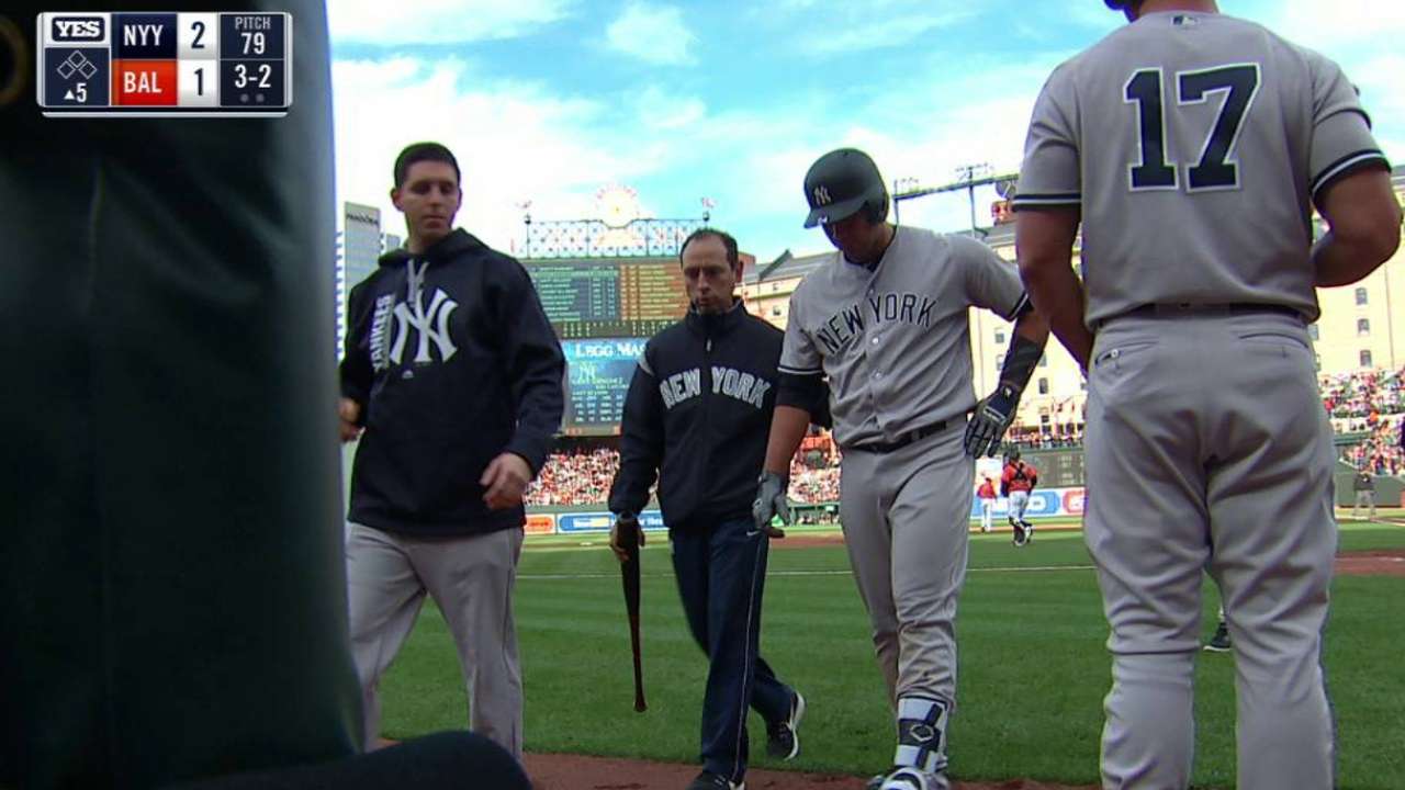 Sanchez exits game after swing