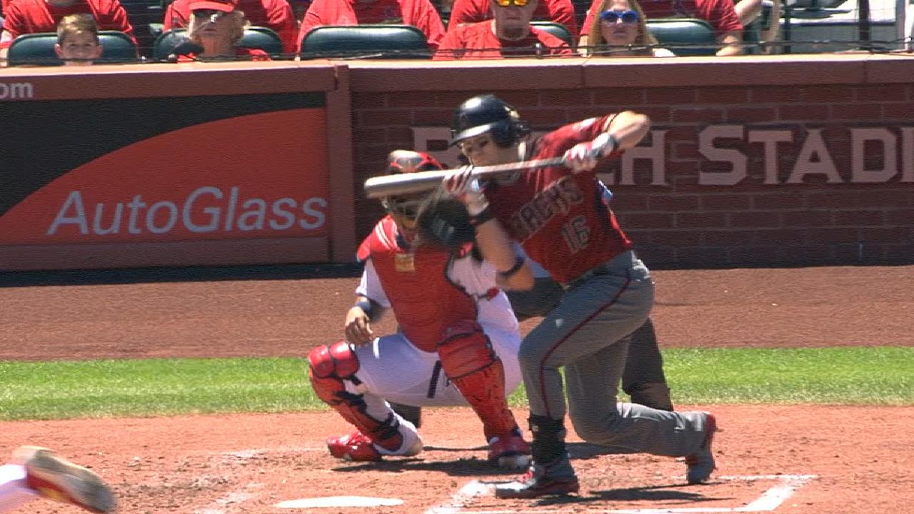 Owings' rehab going well after hand surgery