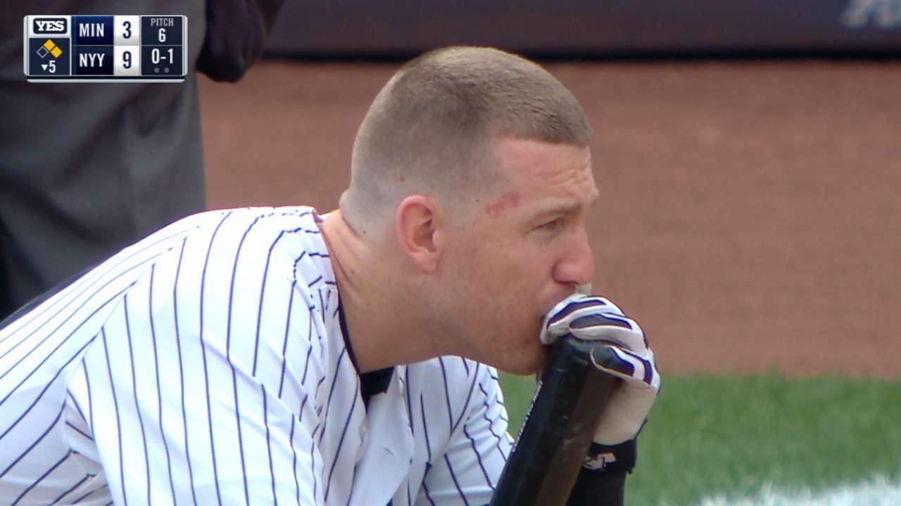 MLB, clubs redoubling efforts on netting
