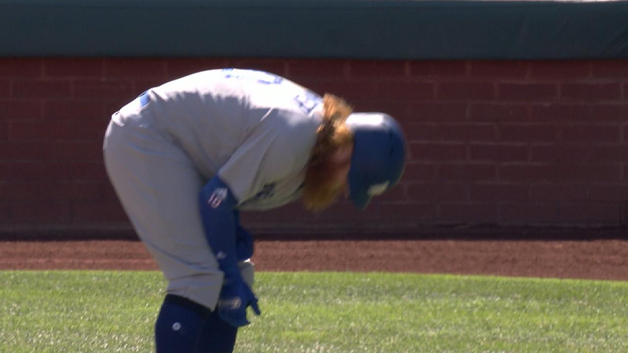 Virus, not hand, keeps Turner sidelined